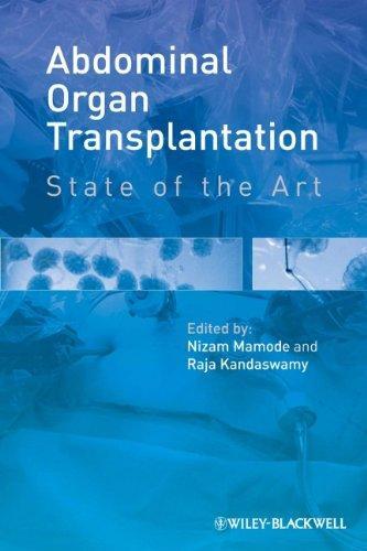 Abdominal Organ Transplantation State Of The Art - dealoox.us